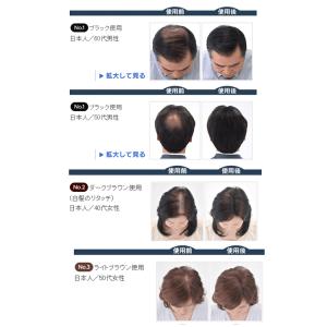 スーパーミリオンヘアー トライアルセット No...の詳細画像3