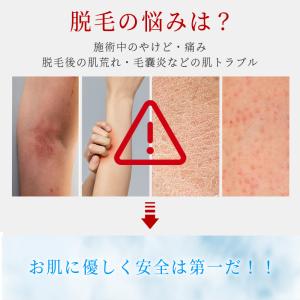 脱毛器 vio対応 21Jパワー サロン級HI...の詳細画像3