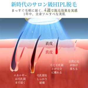 脱毛器 vio対応 21Jパワー サロン級HI...の詳細画像5