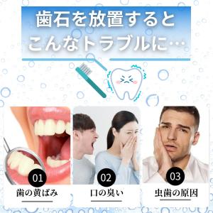 滑り止めが付いて使いやすい 歯石取り 歯石とり...の詳細画像2