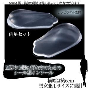 X脚 O脚 矯正 かかと 中敷き インソール ...の詳細画像2