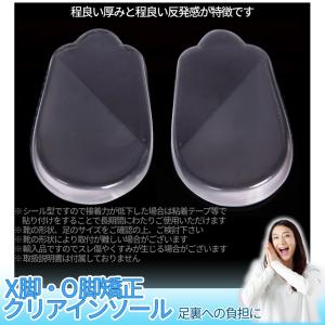 X脚 O脚 矯正 かかと 中敷き インソール ...の詳細画像5