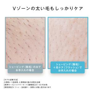 公式店 パナソニック 光美容器 スムースエピ ...の詳細画像5
