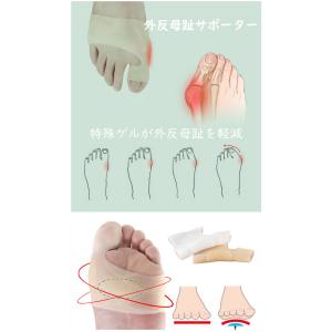 外反母趾 クロス ゲル サポーター 左右兼用 ...の詳細画像1