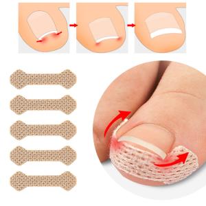 レジスタンスプレート Resistance Plate アクティベーター 7ml 巻き爪