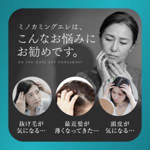 【女性用発毛剤】【公式】『ミノカミング エレ ...の詳細画像2