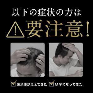 【2本】【ミノキシジル最大5%配合】『ミノカミ...の詳細画像4
