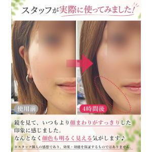 さとう式リンパケア 耳ウラばってんテープ 50...の詳細画像2