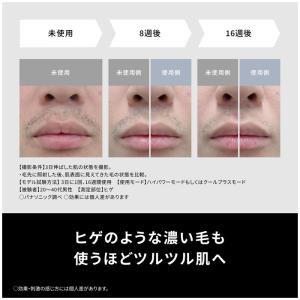 パナソニック 光エステ スムースエピ パワー&...の詳細画像2