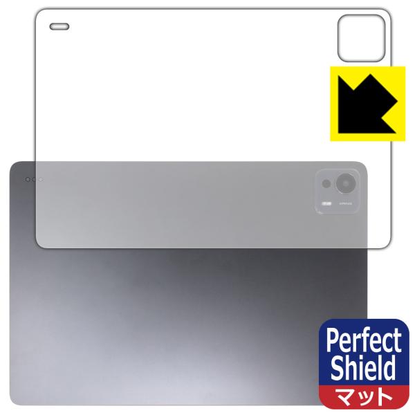 Xiaomi Pad 7 Ultra (14インチ) 対応 Perfect Shield 保護 フィ...