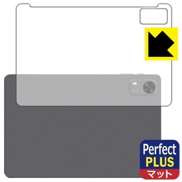 PHILIPS T7315 対応 Perfect Shield Plus 保護 フィルム [背面用]...