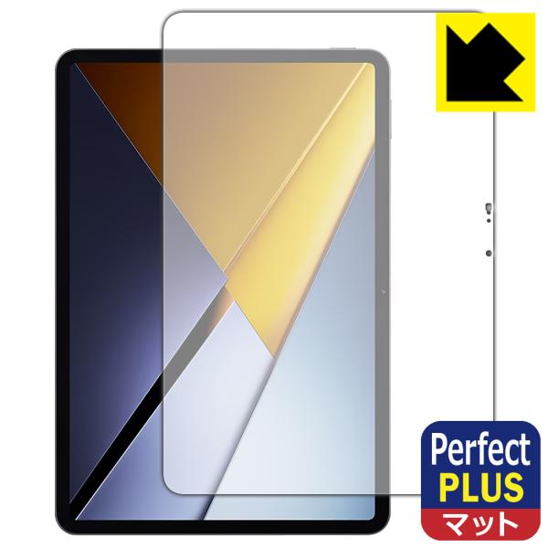 Xiaomi POCO Pad X1 対応 Perfect Shield Plus 保護 フィルム ...