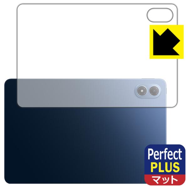Xiaomi POCO Pad M1 対応 Perfect Shield Plus 保護 フィルム ...