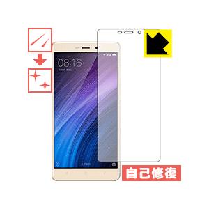 Xiaomi Redmi 4 Prime / Redmi 4 Pro 保護フィルム キズ自己修復