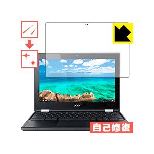 Acer Chromebook R11 保護フィルム キズ自己修復｜pdar