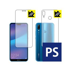 HUAWEI P20 lite 防気泡・防指紋!反射低減保護フィルム Perfect Shield ...