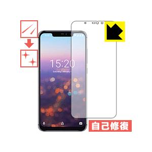 UMIDIGI Z2 Pro / UMIDIGI Z2 自然に付いてしまうスリ傷を修復！保護フィルム...