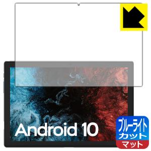 VASTKING KingPad K10 / K10 Pro LED液晶画面のブルーライトを34%カット保護フィルム ブルーライトカット