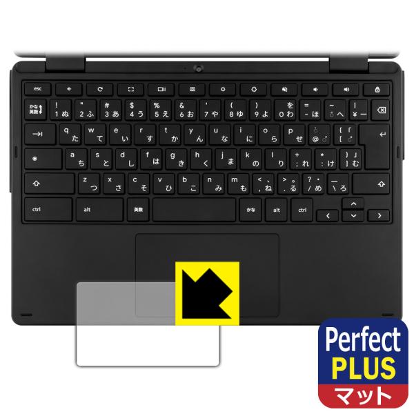 aiwa Chromebook S11 (JA4-LPC1101) 対応 Perfect Shiel...