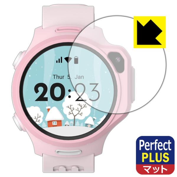 myFirst Fone R2 / R1c 対応 Perfect Shield Plus 保護 フィ...
