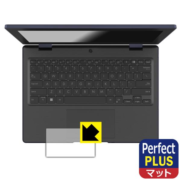 ASUS BR1104F 対応 Perfect Shield Plus 保護 フィルム [タッチパッ...