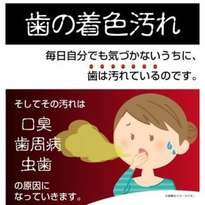 歯を白くする スポンジ su・po・n・ji ...の詳細画像2