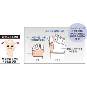 ソルボ外反母趾サポーター スキニーパワーフィッ...の詳細画像3
