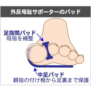 ソルボ外反母趾サポーター スキニーパワーフィッ...の詳細画像4