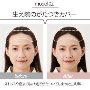 半額セール!産後 抜け毛 薄毛 カバー are...の詳細画像3