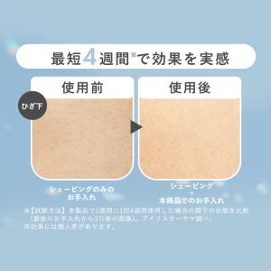 光美容器 ミコラ セルフケア 全身ケア ムダ毛...の詳細画像3