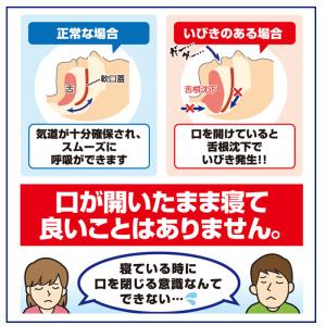 スヤスヤナイトフィルム 30枚入り 口呼吸防止...の詳細画像3