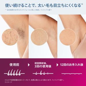 フィリップス ルメア 光美容器8000 シルバ...の詳細画像4
