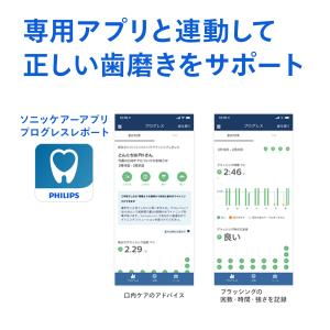 電動歯ブラシ 音波歯ブラシ フィリップス ソニ...の詳細画像5