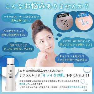 スキンケアセット ニキビ 毛穴ケア ニキビケア...の詳細画像1