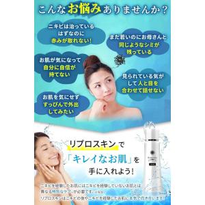 スキンケアセット ニキビ 毛穴ケア ニキビケア...の詳細画像1
