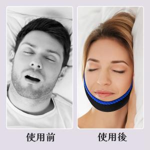 いびき対策ベルト 顎サポーター チンストラップ...の詳細画像3