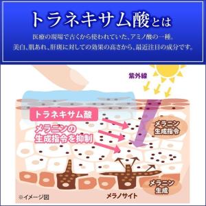 glim(グリム) 薬用トラシーミZ ホワイト...の詳細画像4