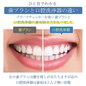 口腔洗浄器 ジェットウォッシャー 口腔洗浄機 ...の詳細画像1