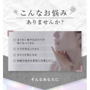 EMS しわ たるみ ハリ ほうれい線アイロン...の詳細画像2