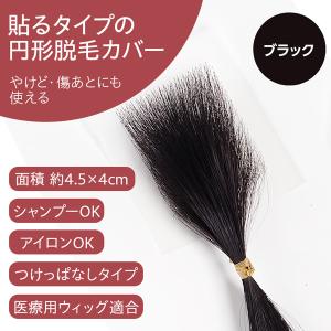 円形脱毛症 隠す 医療用 部分 ウィッグ 自然 男性 女性 プロピア ヘアコンタクト メディカル ブラック シール式｜プロピア Yahoo!店