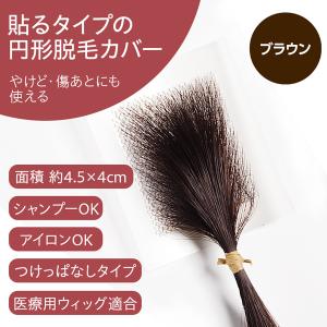 円形脱毛症 隠す 医療用 部分 ウィッグ 自然 男性 女性 プロピア ヘアコンタクト メディカル ブラウン シール式