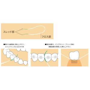 【リニューアル】サンスター バトラー イージー...の詳細画像2