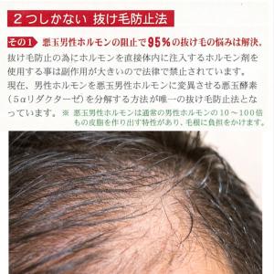 マミヤンアロエ薬用トニック 150ml 3本セ...の詳細画像3