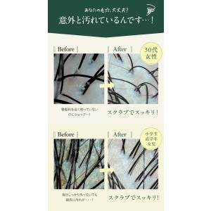 ヘッドスクラブ 頭皮ケア ヘッドスパ スカルプ...の詳細画像2