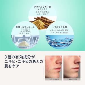 ニキビ ケア メンズ 男性用 保湿ジェル クリ...の詳細画像3