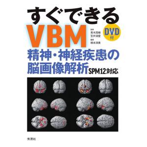 すぐできるVBM: 精神・神経疾患の脳画像解析 SPM12対応 DVD付｜ravi-store