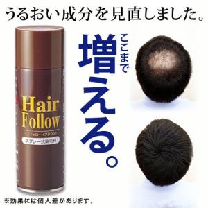 NEW ヘアフォロー ブラウン 薄毛 スプレー ボリュームアップ(代引き不可)｜rcmdse