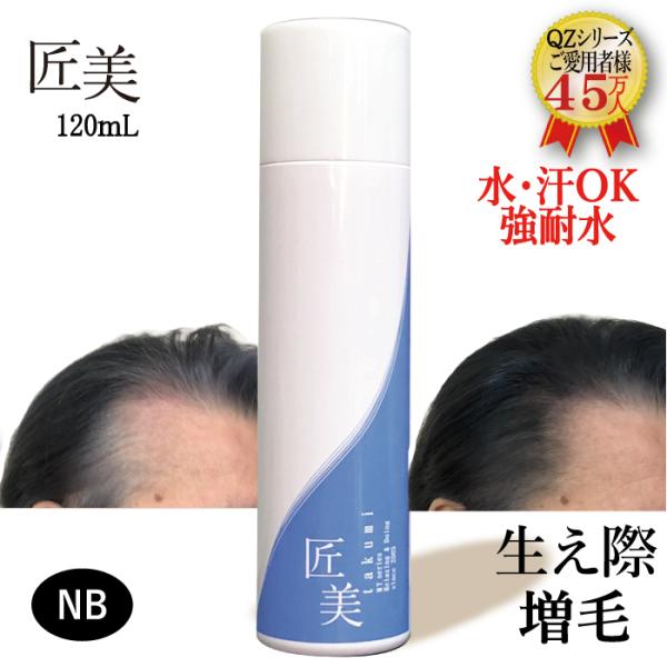 強耐水増毛スプレー「ＱＺーＭＴ匠美 120ml」薄毛隠し 円形脱毛症 増毛剤 細毛 ヘアカバー 生え...
