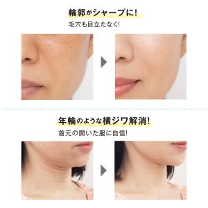 リフトアップテープ かづき・デザインテープ シ...の詳細画像4