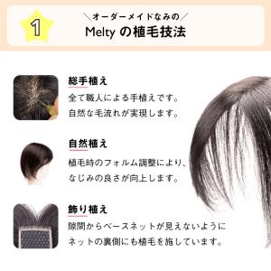 返品OK ピンなしウィッグ メルティ 部分 ウ...の詳細画像5